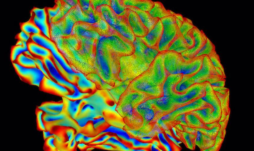A colorful brain scan