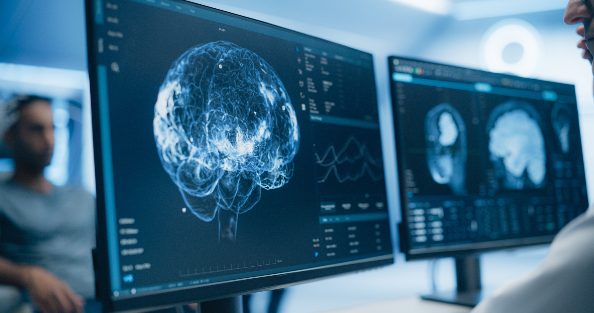Medical Brain Scans on Multiple Computer Screens. Advanced Neuroimaging Technology Reveals Complex Neural Pathways, Display Showing CT Scan in a Modern Medical Environment