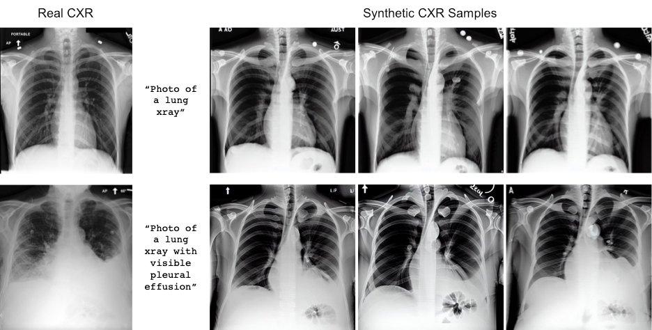 Images of real chest x-rays and those created with Stable Diffusion