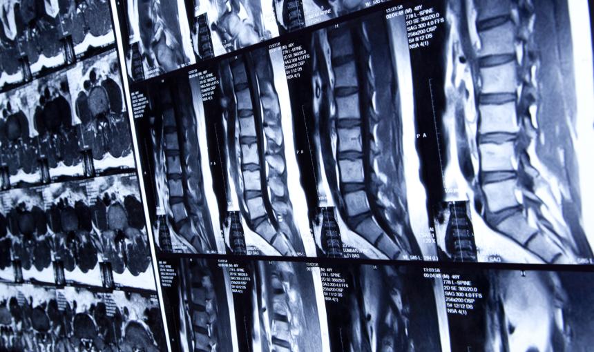x-rays of the lumbar spine