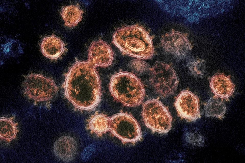 Image of the COVID-19 virus
