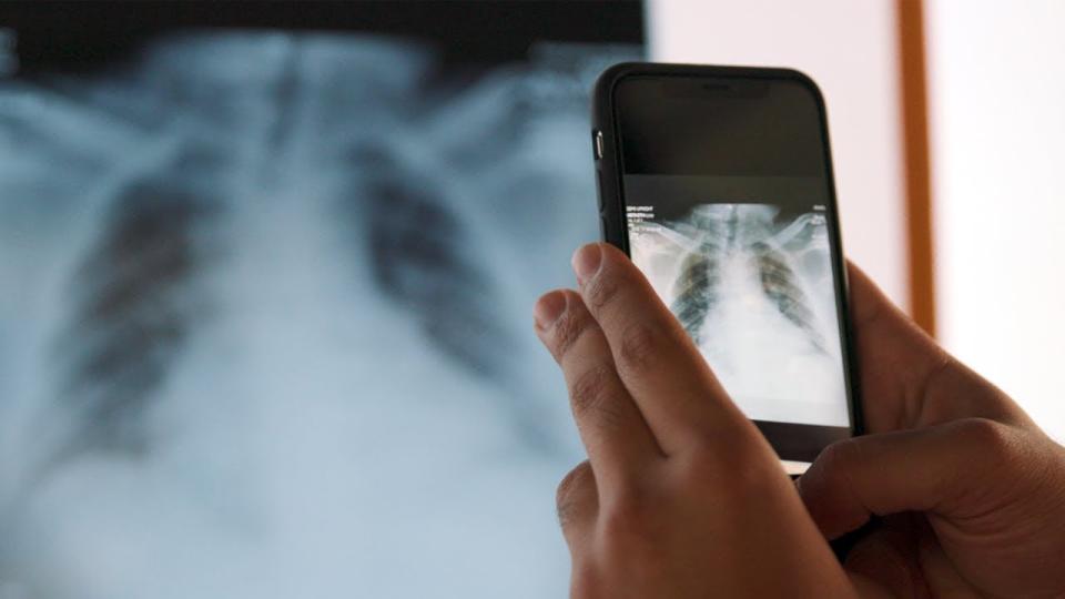 A person's hands hold up a cell phone with the image of an X-ray.