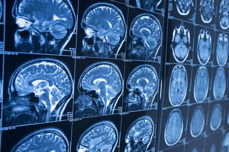 Крупный план компьютерной томографии головного мозга. Медицина, наука и образование МРТ головного мозга. Магнитно-резонансная томография.