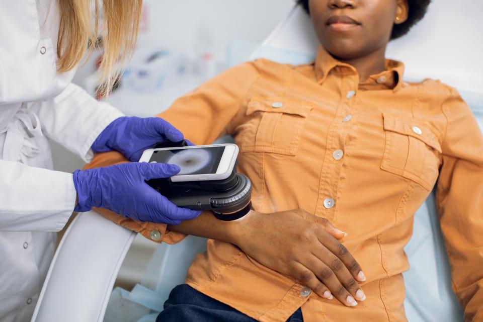 Close up of hands of female doctor dermatologist oncologist holding new generation dermatoscope, examining birthmarks and moles of female patient.